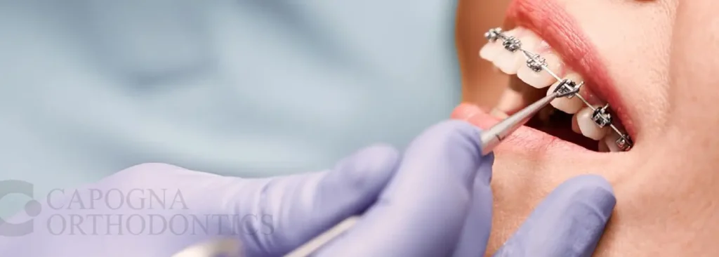 Common Orthodontic Problems