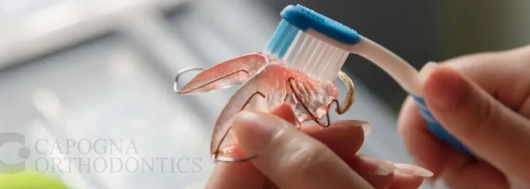 How to Clean Retainers