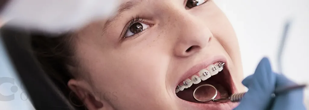 What's the Best Age to Get Braces