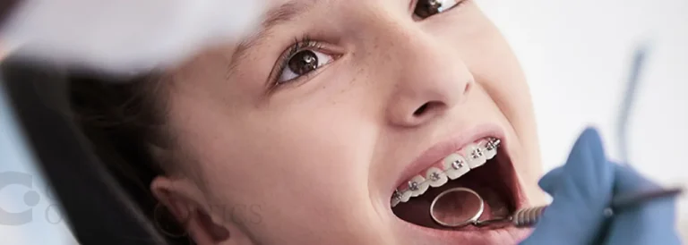 What's the Best Age to Get Braces